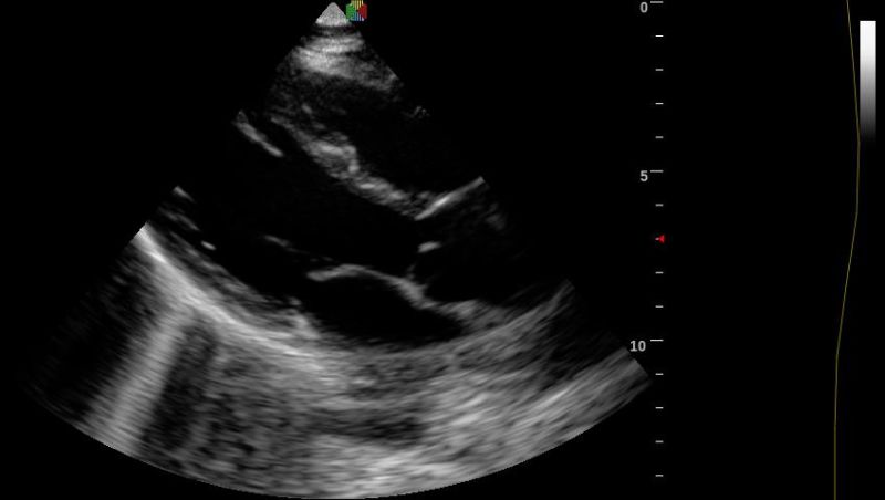 4D Ultrasound Medical Device Partable Doppler Scanner, USG Machine