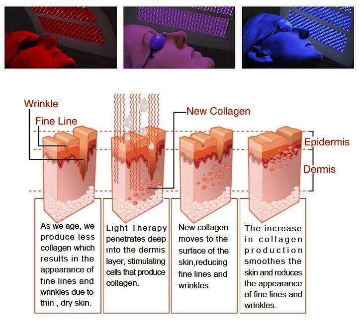 Skin Beauty Equipment LED Phototherapy PDT Light Beauty Machine