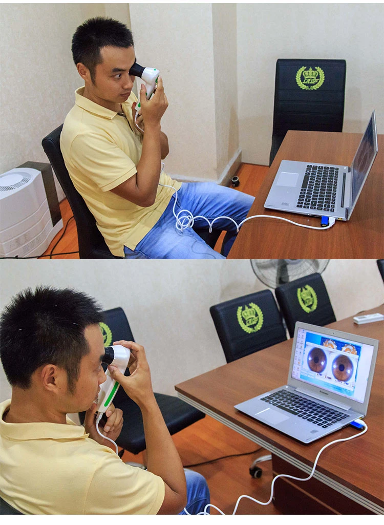 12MP Auto Focus Eye Iris Iridoscope Rapid Body Health Testing Machine