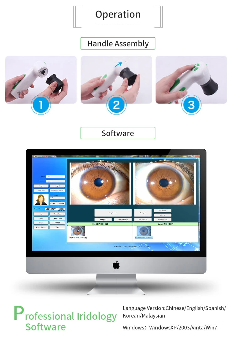 12MP Auto Focus Eye Iris Iridoscope Rapid Body Health Testing Machine