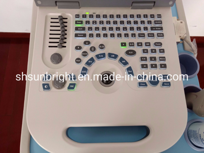 New Best Ultrasound 2 Probe Ports 2D Image Sun 806g