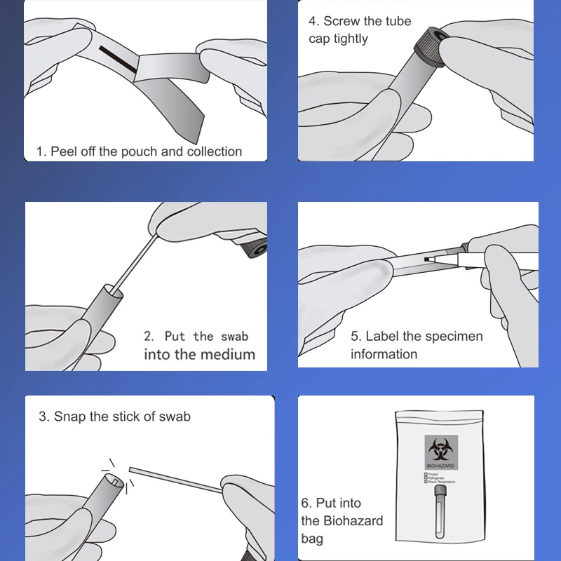 Disposable Virus Specimen Collection Tube Viral Transport Tube Vtm Tube with Nasal and Oral Throat Swab