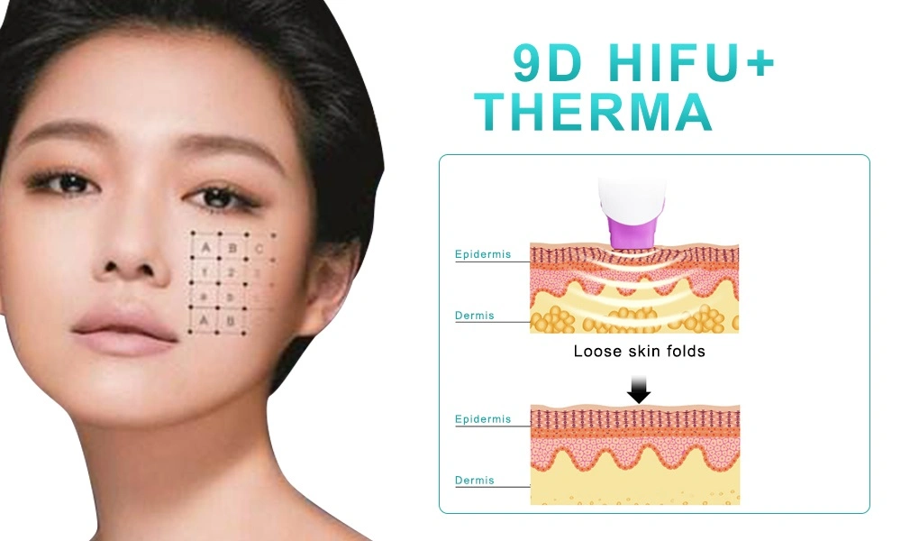 9 Hifu  Thermal Maggie  Beauty Hifu Machine for Sales