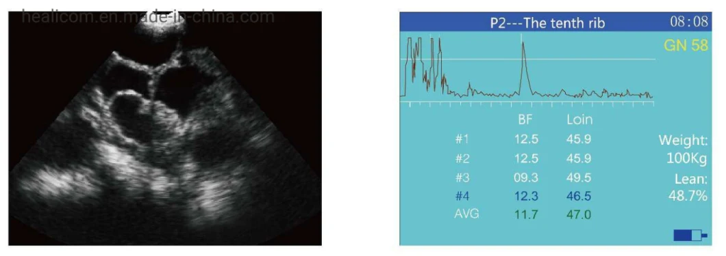 New Product Veterinary Ultrasound Scanner Full-Digital Portable Veterinary Ultrasound