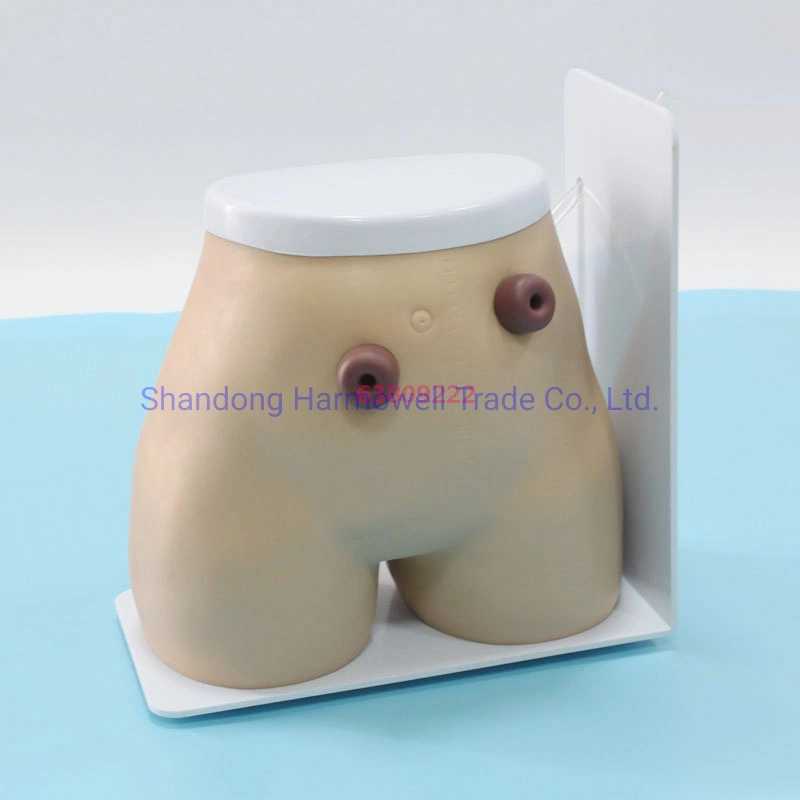 Senior Fistula Colostomy Nursing Model