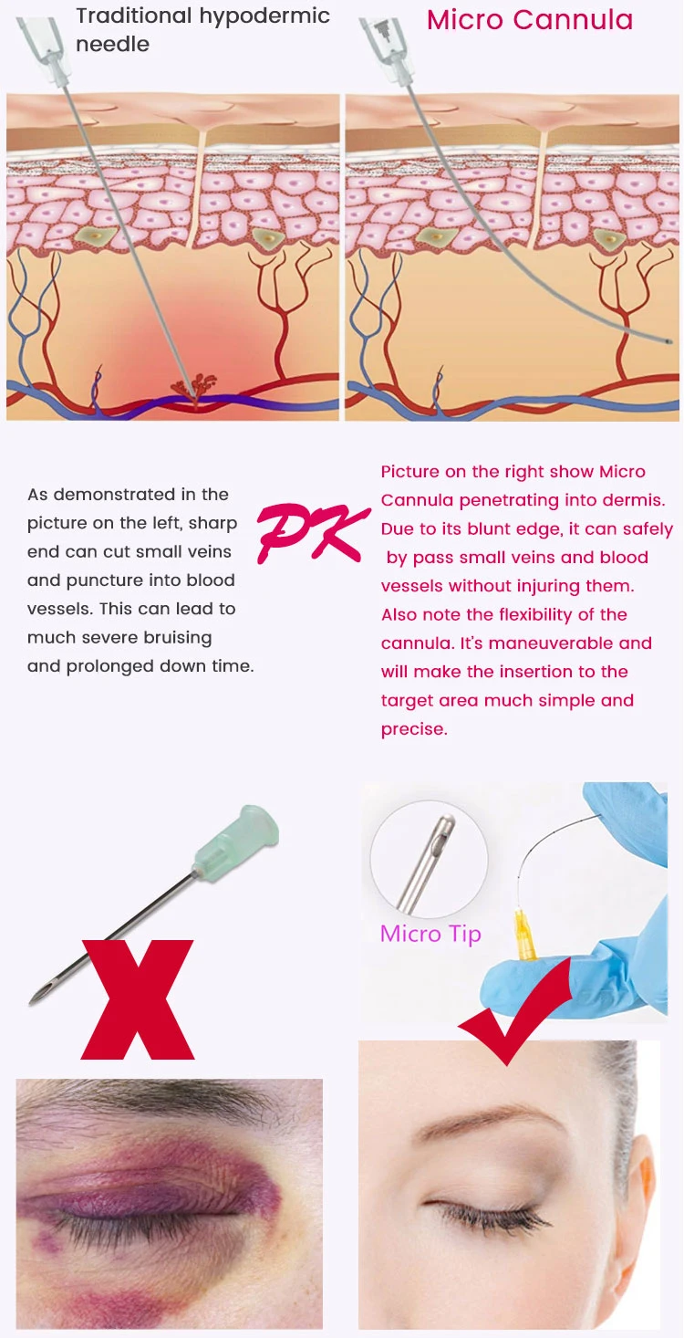 Medical Hypodermic Needle Cannula Ha Dermal Filler