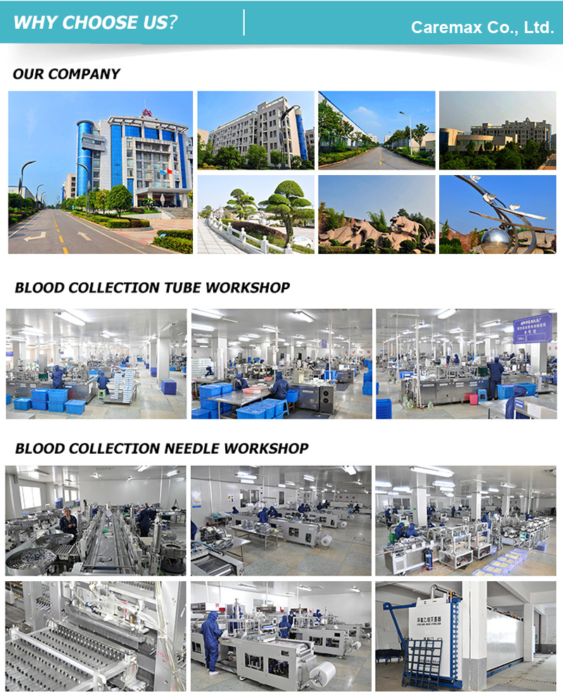 Vacuum Blood Collecting Tubes, Gel and Clot Activator Tube