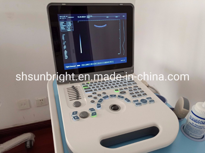 Sun-806g Veterinary Medical Device Sheep Portable-Ultrasound-for-Sheep