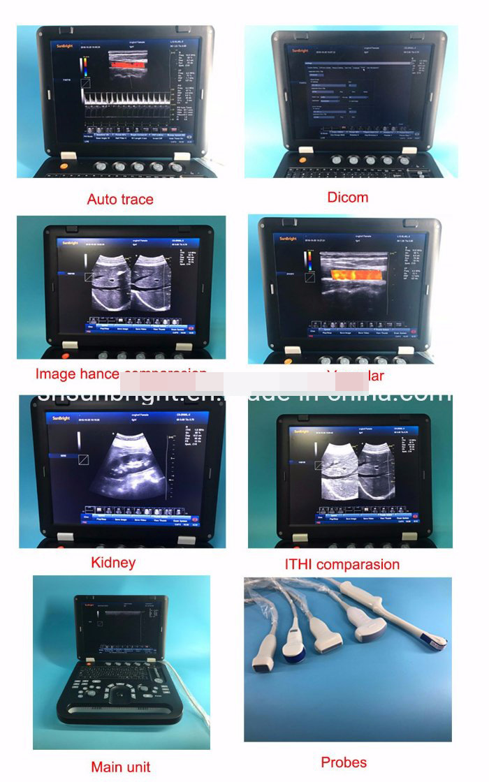 Portable Ultrasound Unit Medical Device Portable 3D New Color Doppler