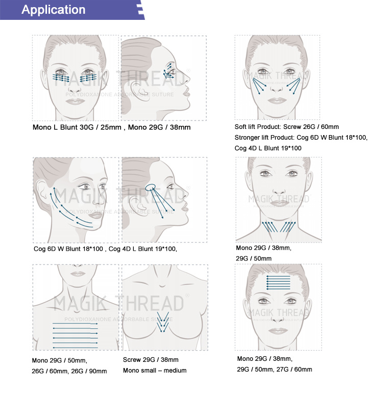 Long Lasting 4D Thread Lift with Best Price