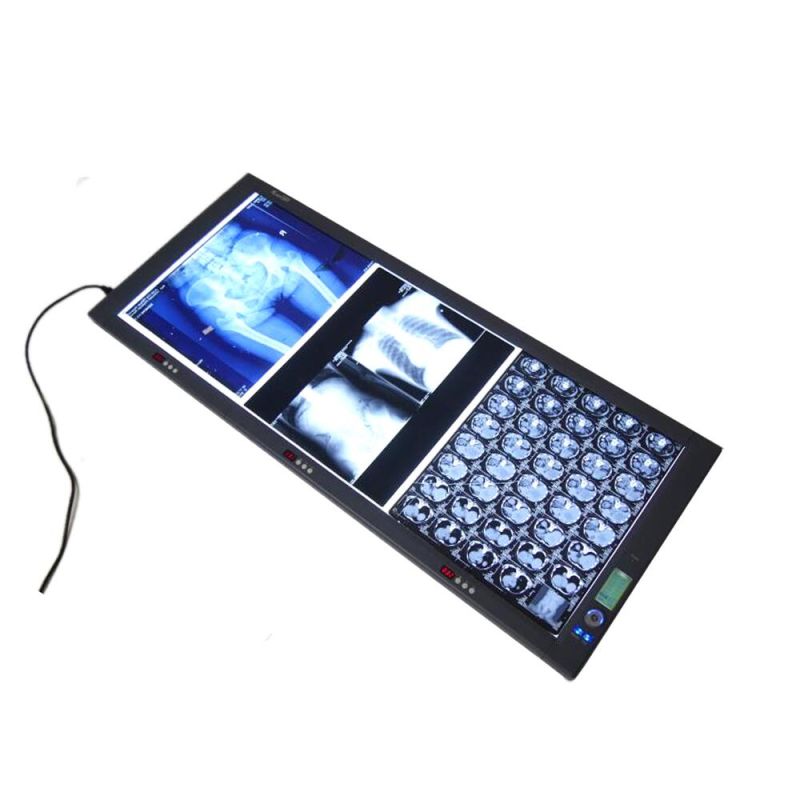 Chinese Manaufactuer for Medical Film Illuminator Viewer