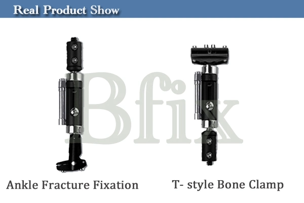Surgical External Fixation