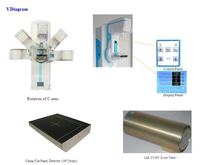 FM-M600 Digital X-ray Mammogram Equipment, Digital Mammography Machine for Breast Cancer Images Mammogram