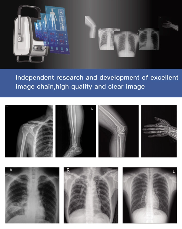 My-D019f Medical Products Dr System Mobile X-ray Scanner Digital X Ray Portable Machine