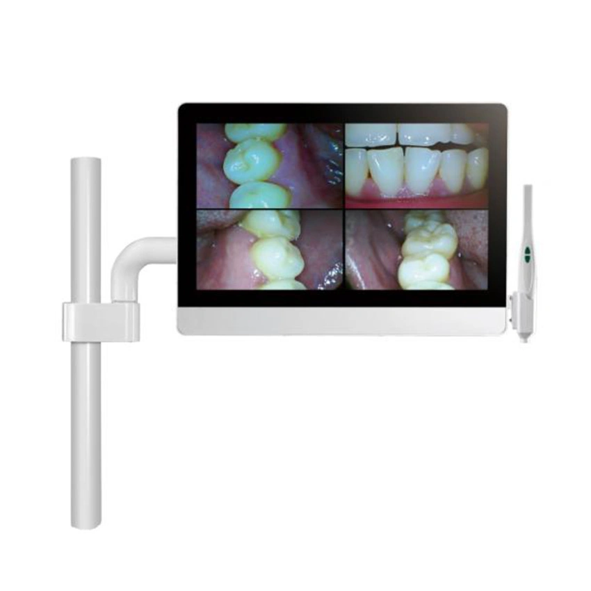 My-M069c Dental Apparatus Medical Intraoral Camera All in One Best Dental Intra Oral Camera