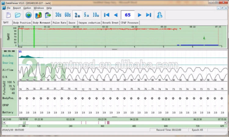 9 Channels Sleep Monitoring Device for Sleep Disorder Diagnostic