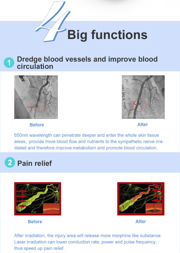 Low Level Cold Laser Therapy Device for Skin Healing