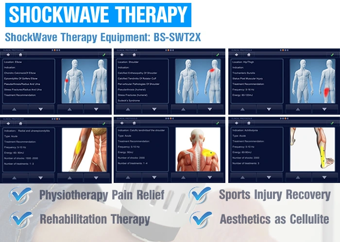 Shockwave Therapy Machine Physiotherapy and Rehab Shock Wave Equipment Medical Ce