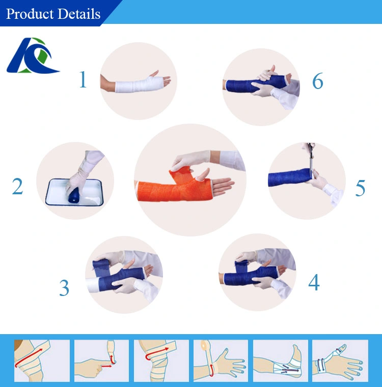 Manufacture Kangda Fiberglass Cast Tape Sleeve Cast