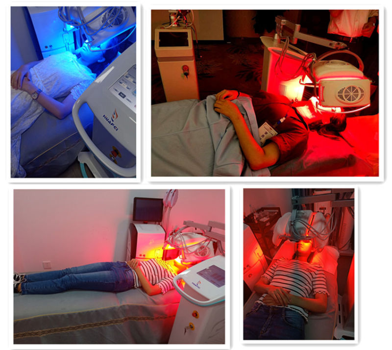 Red Light Therapy for Wrinkles Pdf Machine