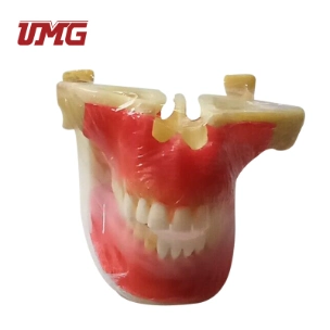 Orto Implant Practice Model Dental Clinic Tooth Model