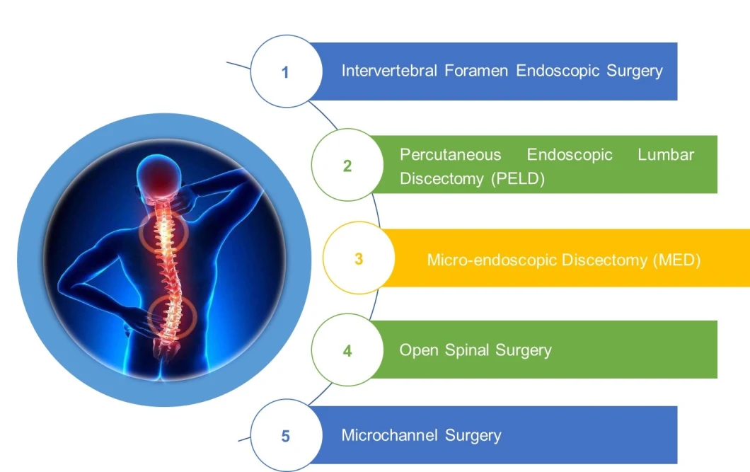 Endoscopic Spine Drill/Surgical Drill for Spinal Surgery/Lateral Bur for Spine Surgery