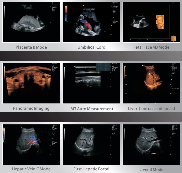 Full Digital Trolley Color Doppler Ultrasound Imaging Scanner