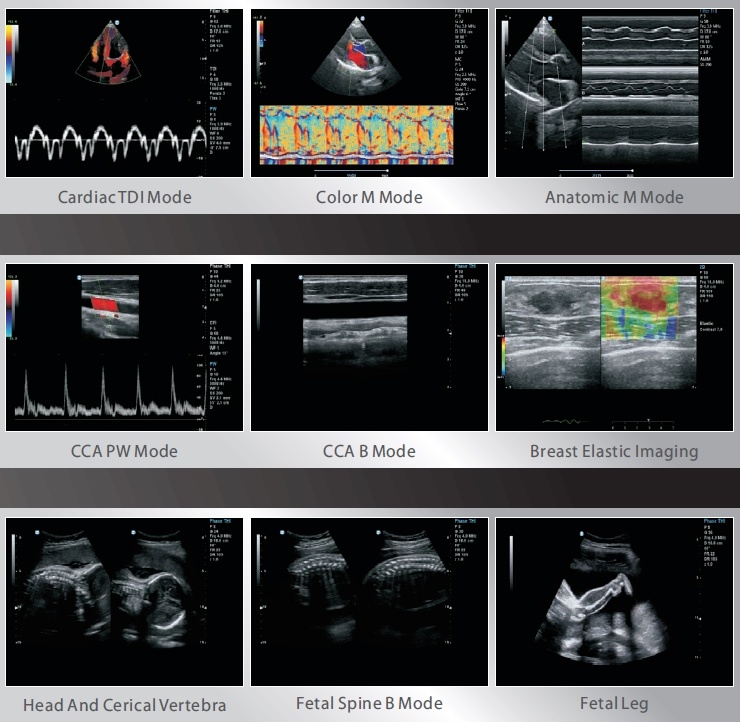 Full Digital Trolley Color Doppler Ultrasound Imaging Scanner