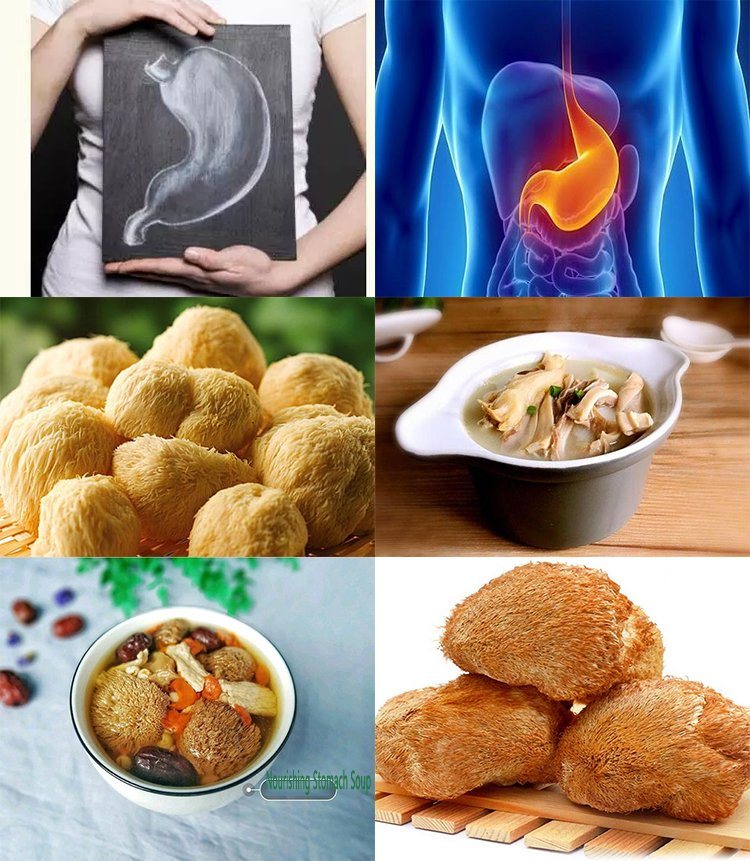 Mushroom Polysaccharide Series Organic Hericium Erinaceus Mushroom Extract 30% Polysaccharides Mushroom