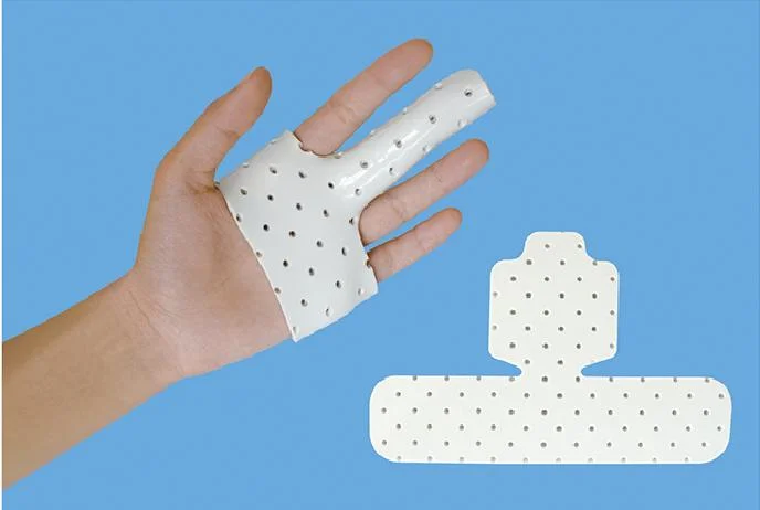 Thermoplastic Plate Splint for Finger and Wrist