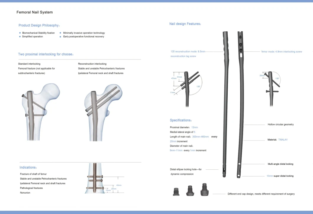 Proximal Expert Femoral Nail, Orthopedic Femur Intramedullary Implant