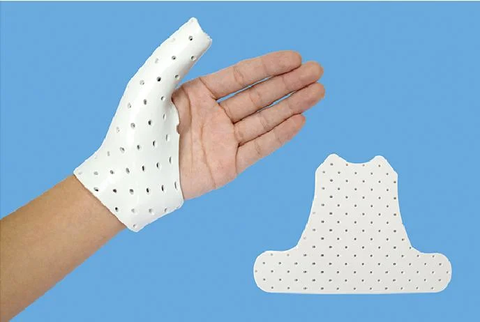 Thermoplastic Plate Splint for Finger and Wrist