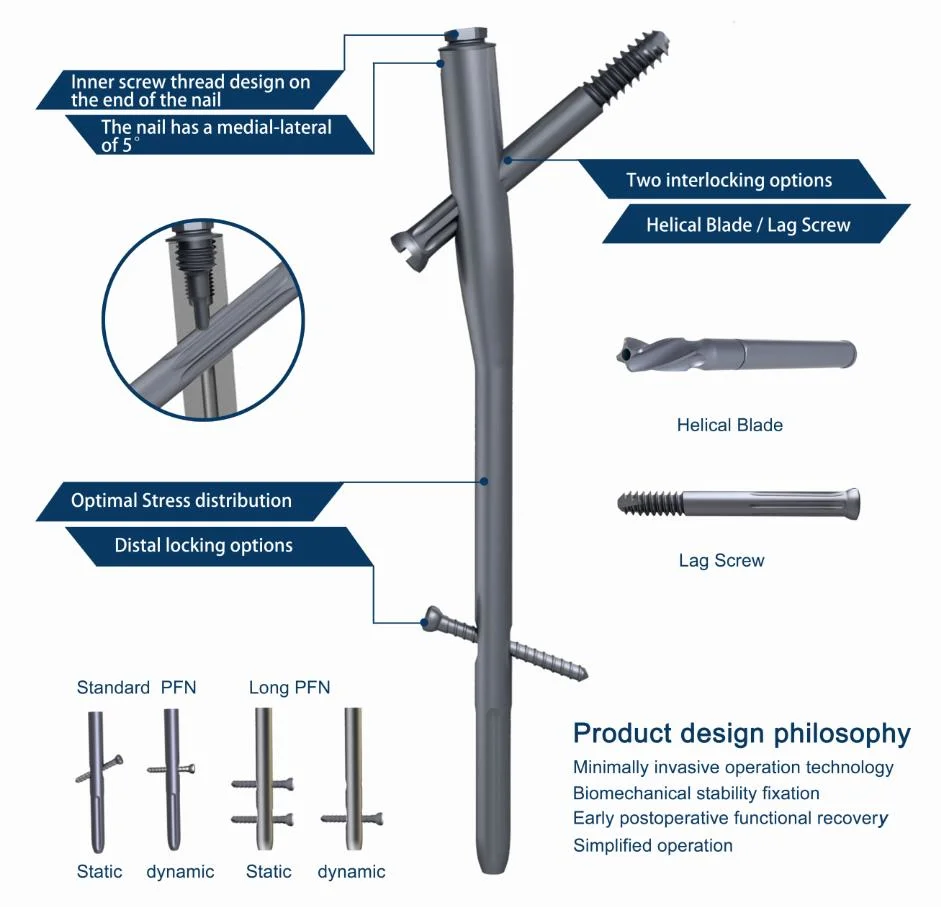 Nail Supplies Proximal Femoral Interlocking Intramedullary Pfna Nail Orthopedic Implant