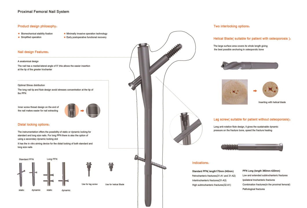 Pfn/Pfna Proximal Femur Nail, Orthopedic Femoral Intramedullary Implant