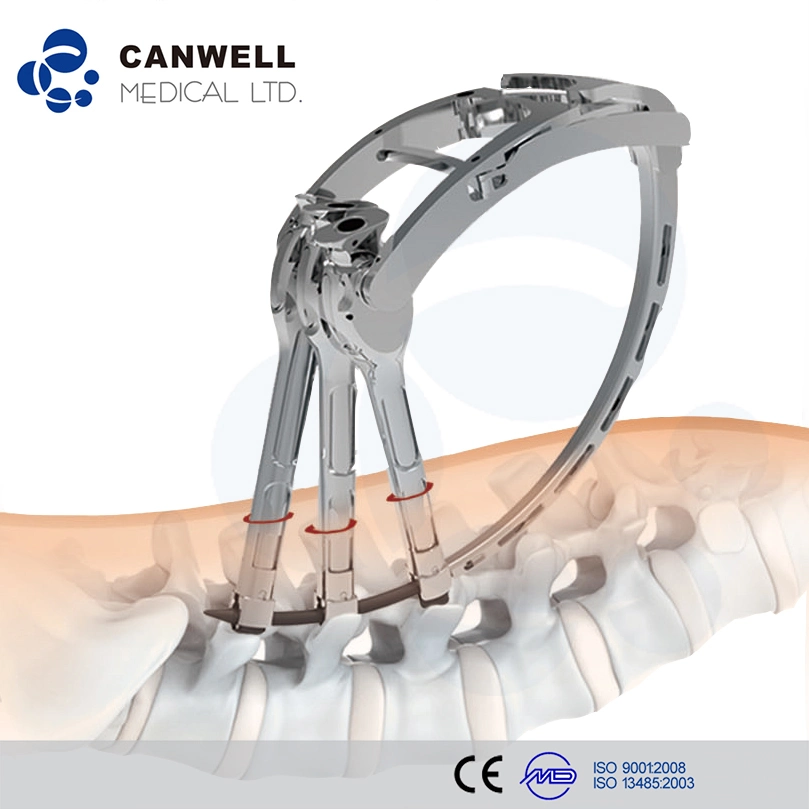 Canwell Minimally Invasive Spine Instruments Medical Implants Thoracolumbar Pedicle Screws