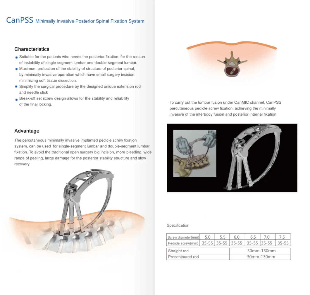 Canwell Minimally Invasive Spine Instruments Medical Implants Thoracolumbar Pedicle Screws