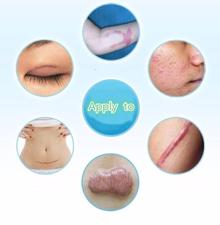 Silicone Removal Patch Reusable Acne Gel Scar Therapy Silicon Patch Remove Trauma Burn Sheet Skin Repair