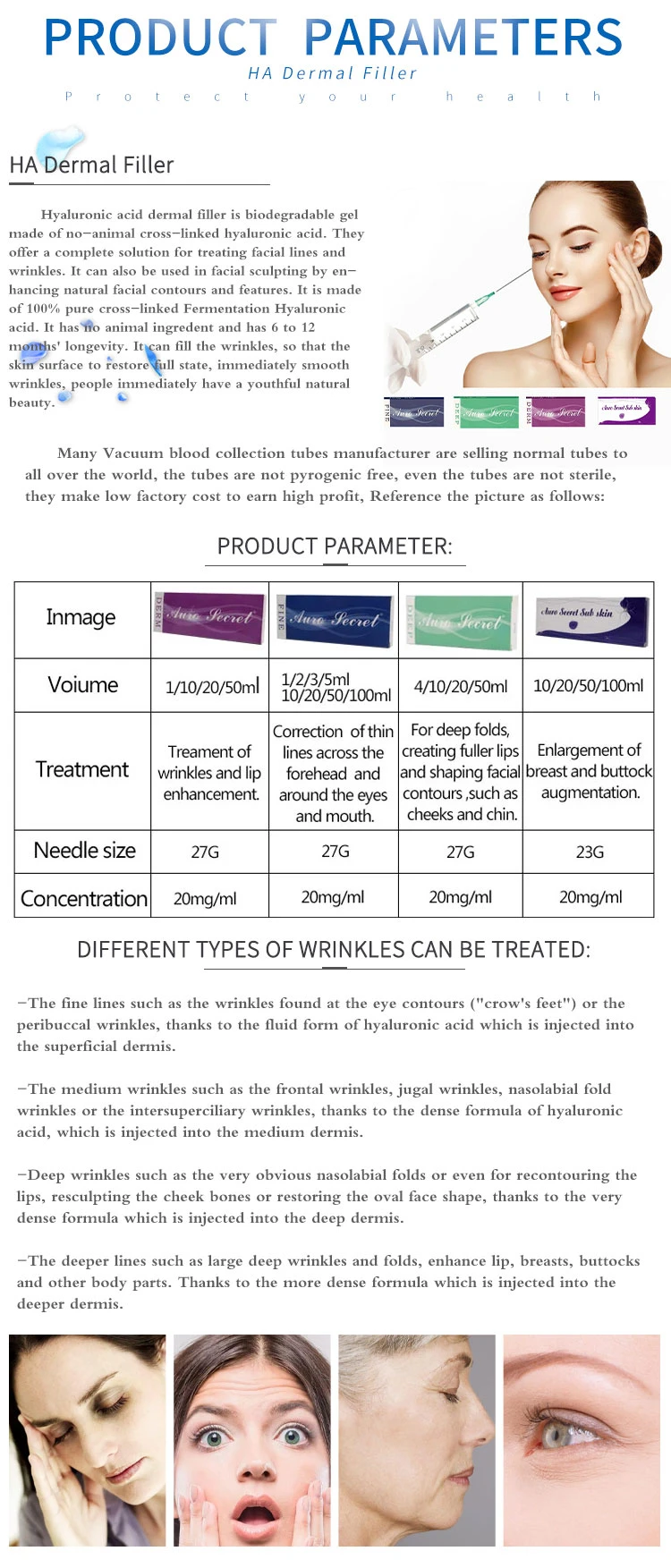 Hyaluronic Acid Nasolabial Folds Iniettabile Augmentation Expansion Dermal Filler