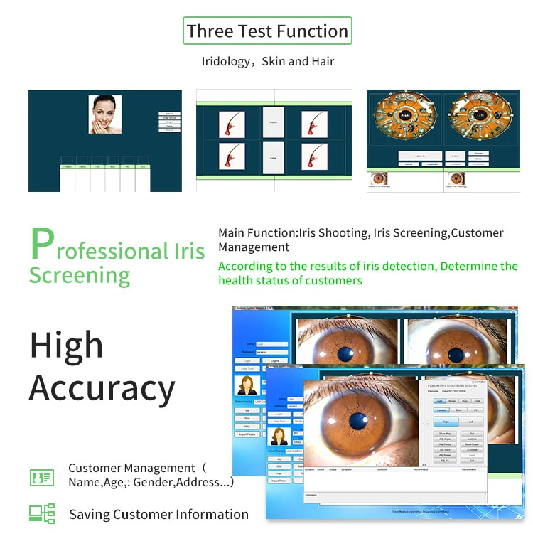 12MP Auto Focus Eye Iris Iridoscope Rapid Body Health Testing Machine