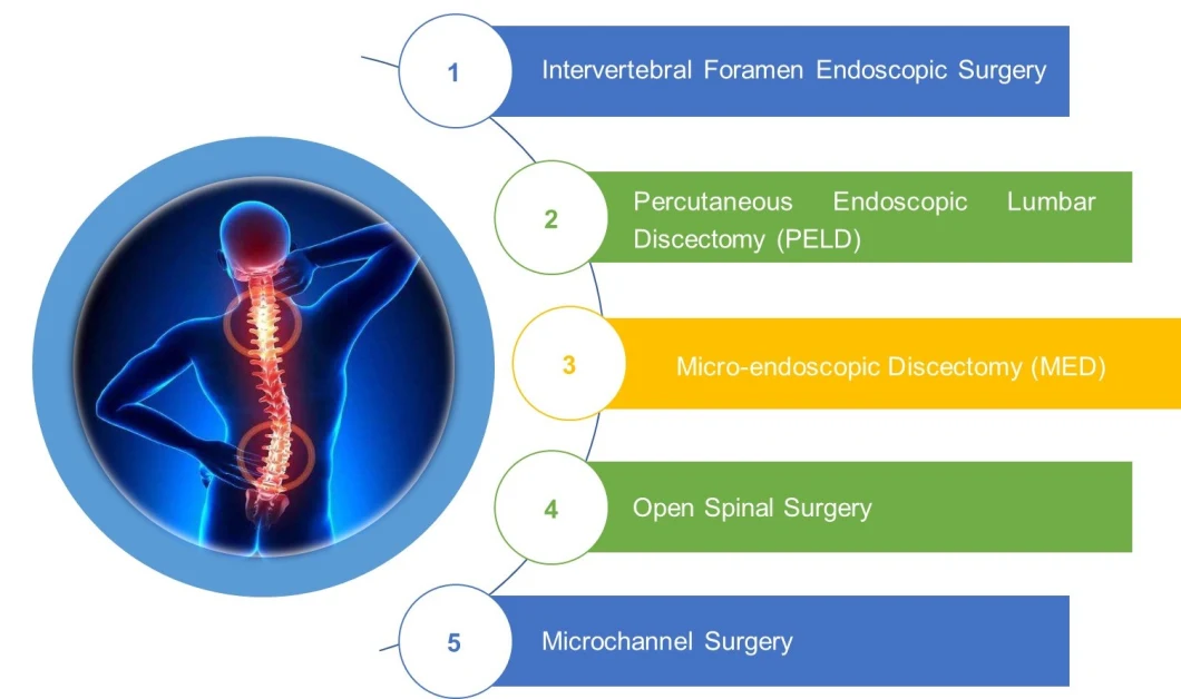 Surgical Spinal Endoscope Drill/Bur/Spine Drill/ Spinal Bur/ High Speed Drill/ Orthopedic Drill/Peld