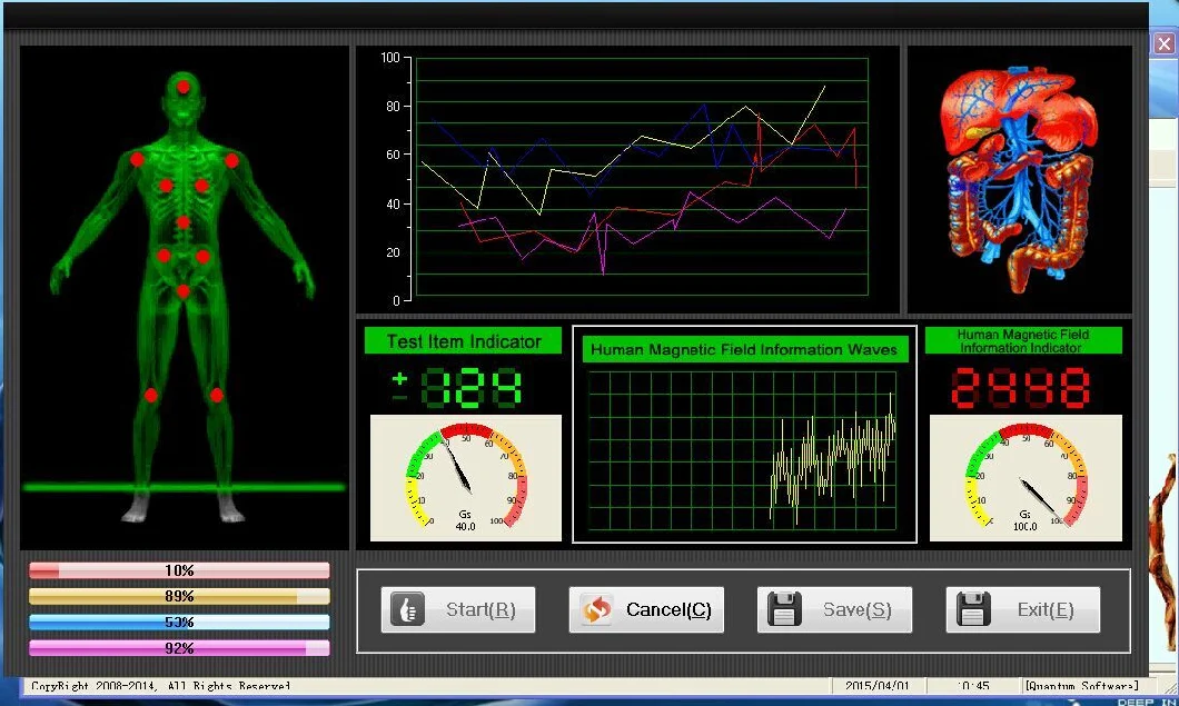 2021 Newest Body Health Analyzer Analysis and Therapy Function Quantum Resonance Magnetic Analyzer Mslhq403