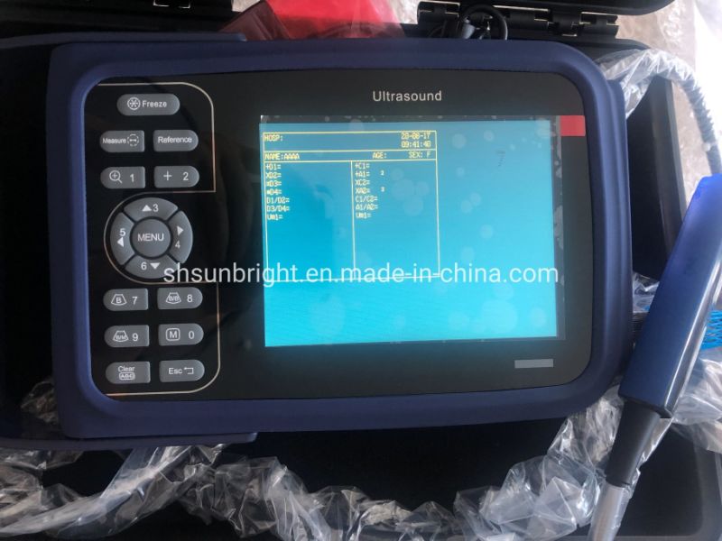 Vet Farm Ultrasound Scanner Veterinary Ultrasound for Animals