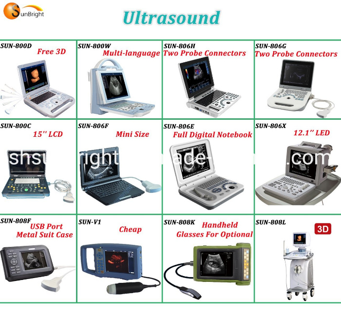 Vet Farm Ultrasound Scanner Veterinary Ultrasound for Animals