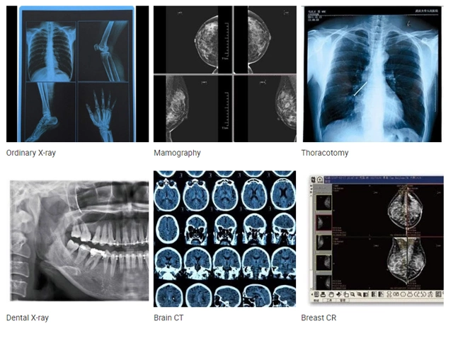 A3 A4 Pet Radiology 210um Blue Inkjet Medical X-ray Film