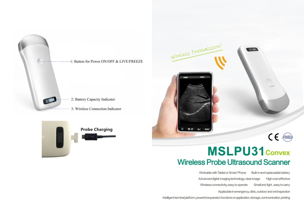 Smart Mini Waterproof Wireless Probe Type Ultrasound Probe Mslpu31