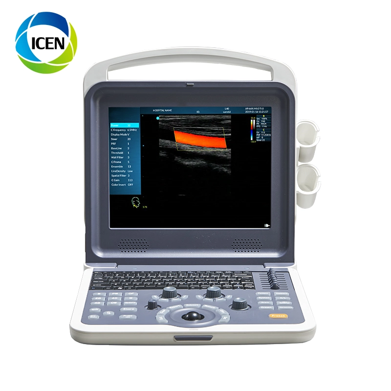 IN-AK0 Mindary USB Probe 3D Color Doppler Transvaginal Ultrasound Machine