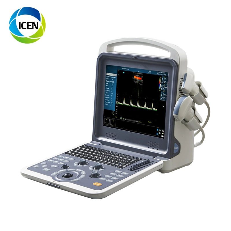 IN-AK0 Mindary USB Probe 3D Color Doppler Transvaginal Ultrasound Machine