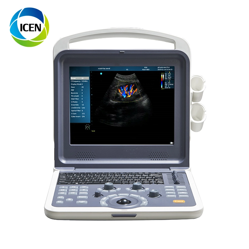 IN-AK0 Mindary USB Probe 3D Color Doppler Transvaginal Ultrasound Machine