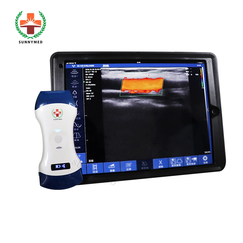 Sy-AC51 Double Head Convex/Linear/Micro-Convex/Transvaginal Probe Wiress Ultrasound Probe