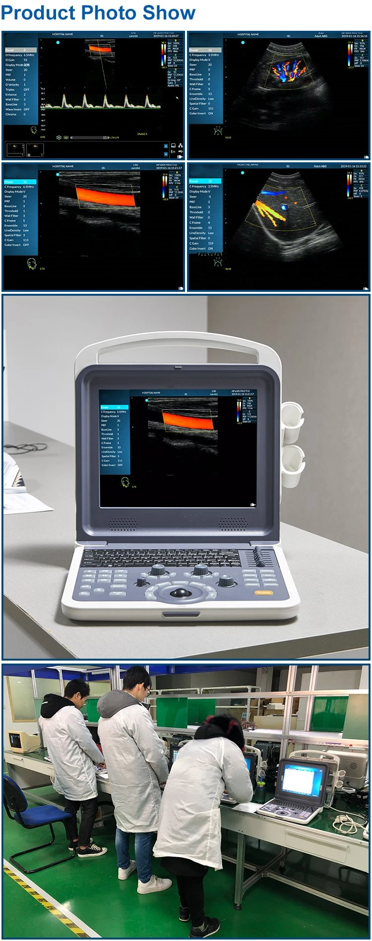 IN-AK0 Mindary USB Probe 3D Color Doppler Transvaginal Ultrasound Machine